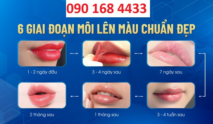 Phun môi bao lâu thì lên màu đẹp - Hotline tư vấn: 0364 555 388