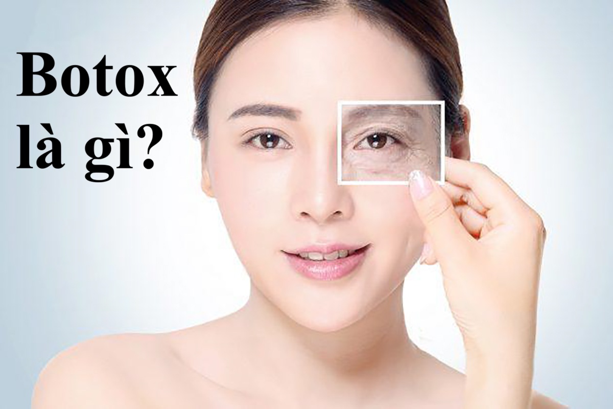 Botox là gì? Công dụng và giá tiêm botox