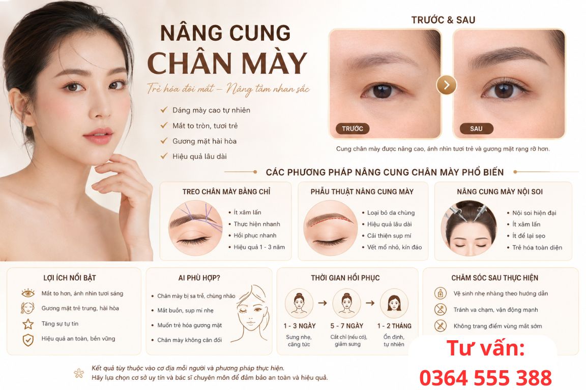 Nâng cung chân mày là gì? - Tư vấn: 0364 555 388